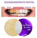 SmileKit Violeta™ - Crema Dental Blanqueadora